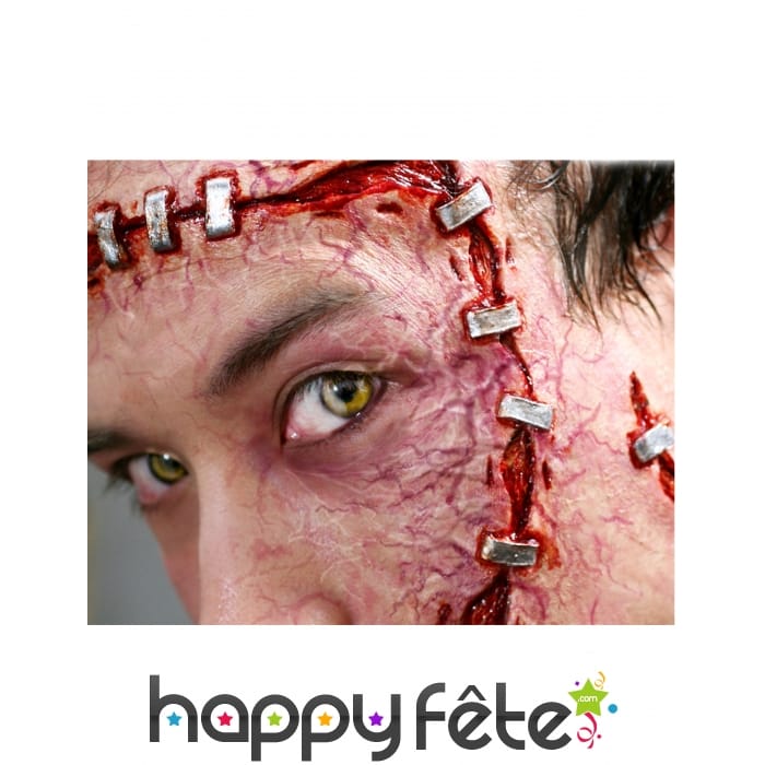 Blessures agrafées par transfert à l eau