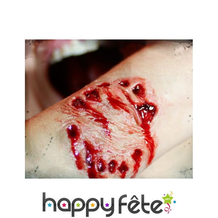 Blessure en forme de morsure