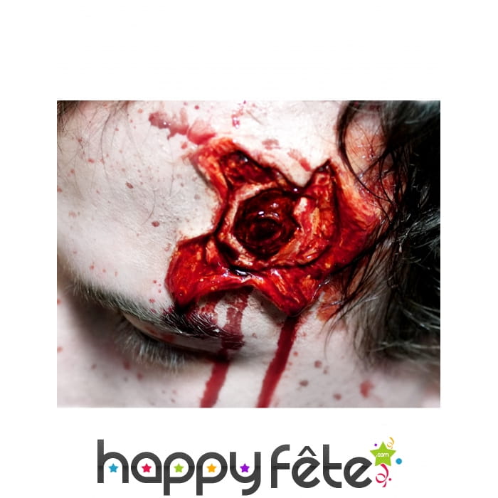 Blessure impacte de balle creux