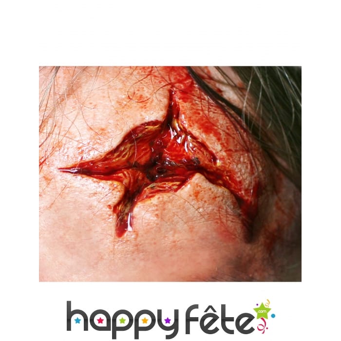 Blessures peau arrachée par transfert à l eau