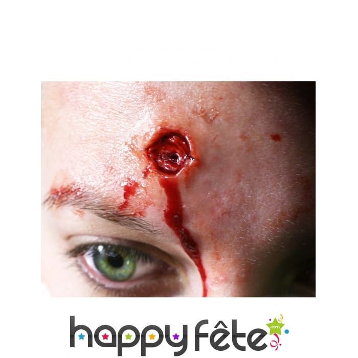 Brûlures rondes par transfert à l'eau