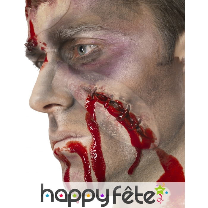 Cicatrice en sang avec agrafes