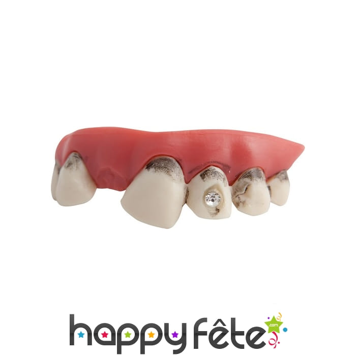 Fausses dents sales avec strass