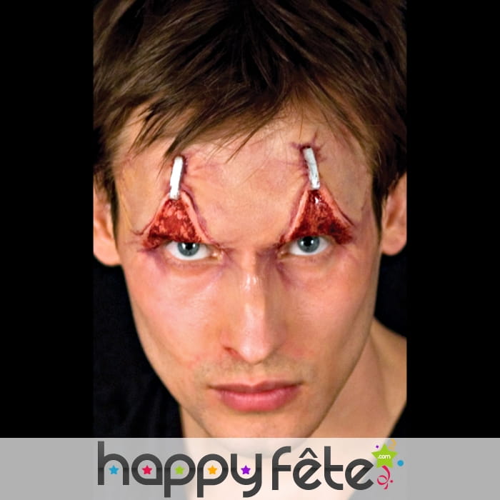 Fausses Paupières agrafées et retournées