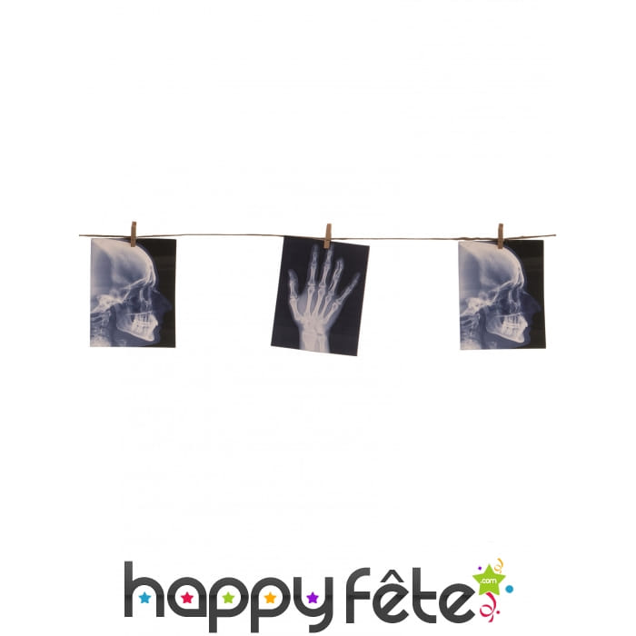 Guirlande de radiographies d'hôpital de 1.60 m