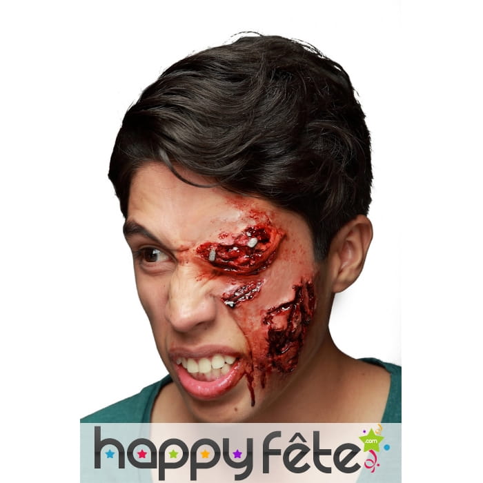 Oeil blessé et infecté en latex