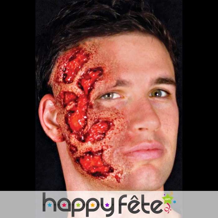 Postiche latex de brûlure