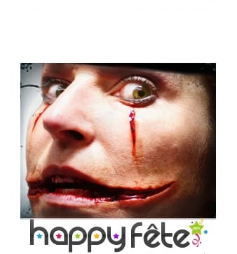 Blessure de bouche par transfert à l'eau