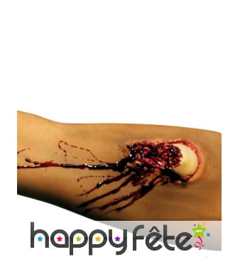 Fausse fracture ouverte du bras