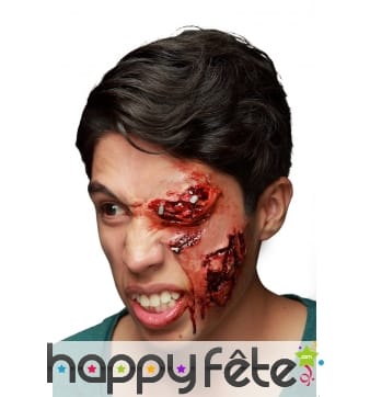 Oeil blessé et infecté en latex