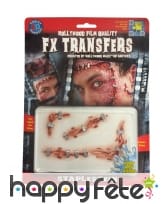 Blessures agrafées par transfert à l eau, image 1