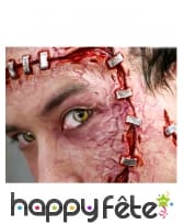 Blessures agrafées par transfert à l eau