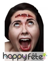 Blessure cicatrice agrafée en latex