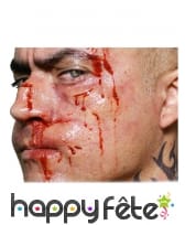 Blessures de boxe par transfert à l'eau