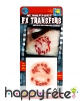 Blessure en forme de morsure, image 1