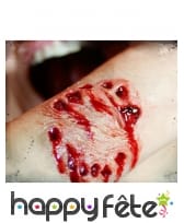 Blessure en forme de morsure