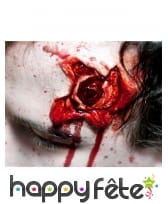 Blessure impacte de balle creux