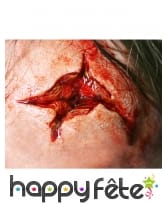 Blessures peau arrachée par transfert à l eau