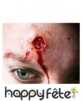 Brûlures rondes par transfert à l'eau