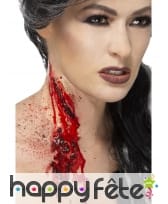 Cicatrice cou femme, image 2