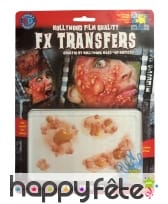 Cloques purulentes par transfert à l eau, image 1