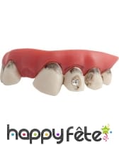 Fausses dents sales avec strass