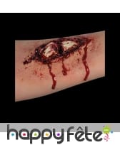 Fausse fracture ouverte, postiche