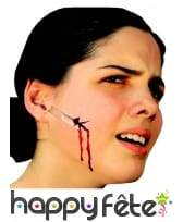 Fausse plaie lacérée de 6cm