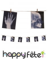 Guirlande de radiographies d'hôpital de 1.60 m, image 2