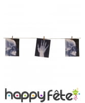 Guirlande de radiographies d'hôpital de 1.60 m