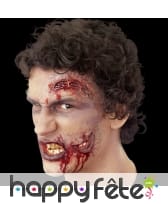 Grosses plaies ouvertes en sang et en latex