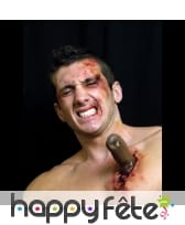 Manche de couteau planté dans la peau