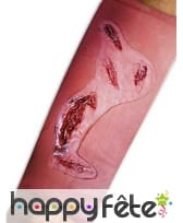 Manchon plaie en sang avec coléoptère