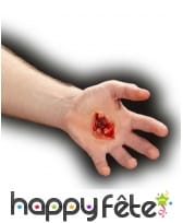 Plaie infectée, image 1