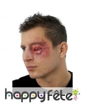 Postiche oeil hématome